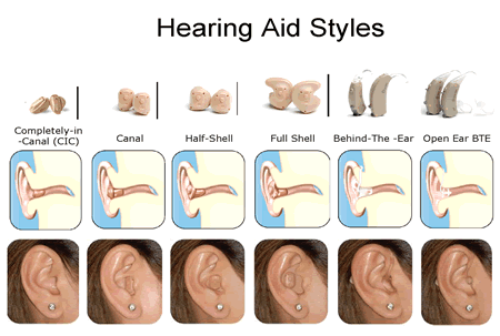 Audiologist Wilmington Nc