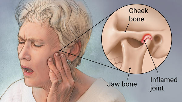 Your ear pain may not be from the ear at all. It might be from your TMJ